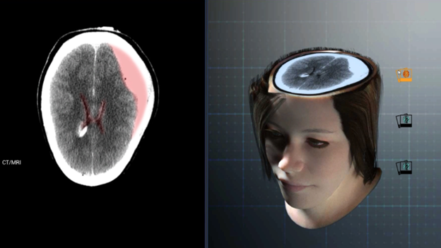 3D model with MRI images spliced